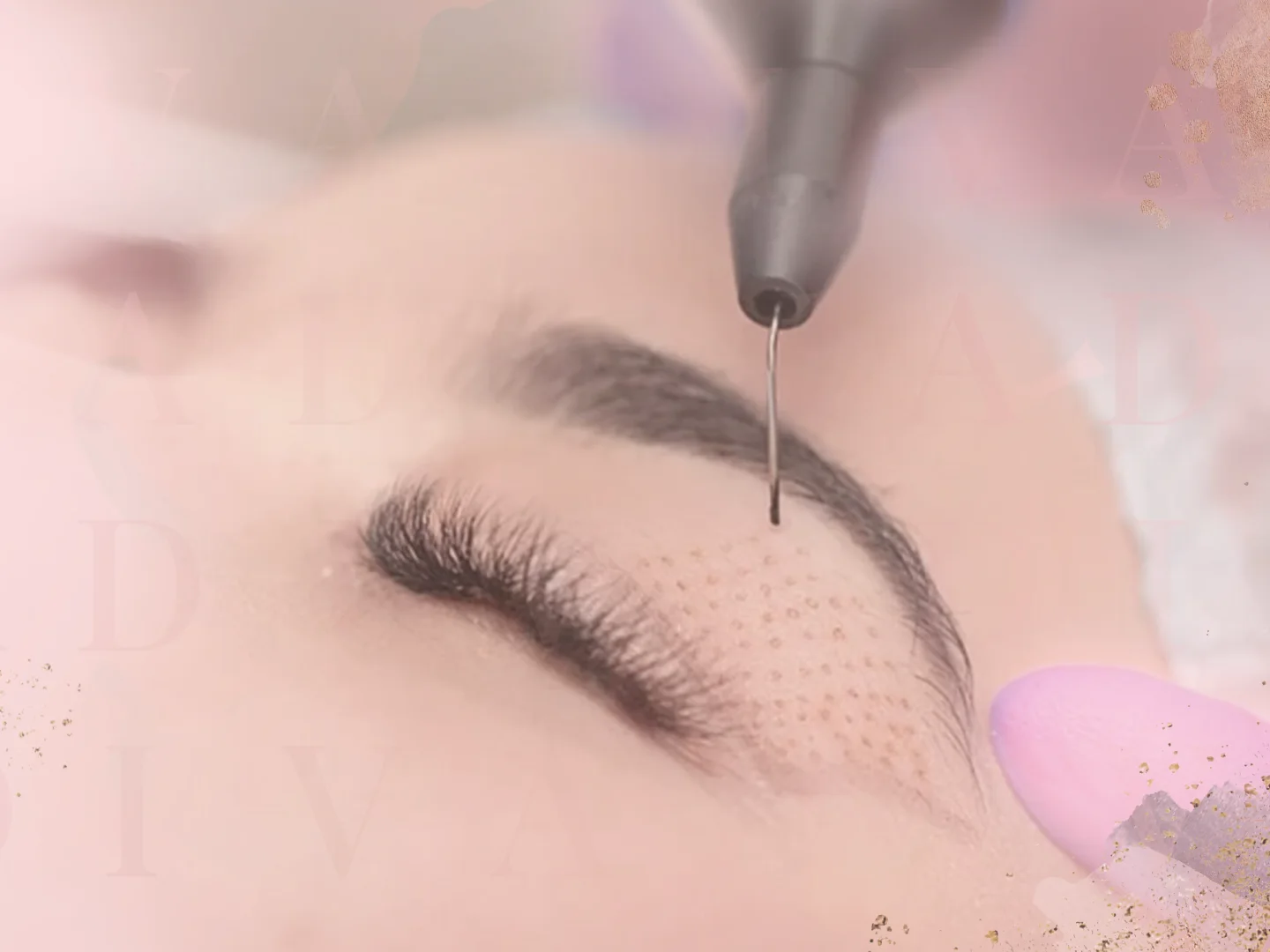 Plexr Plus: The Non-Surgical Eyelid Lift That's Changing Everything