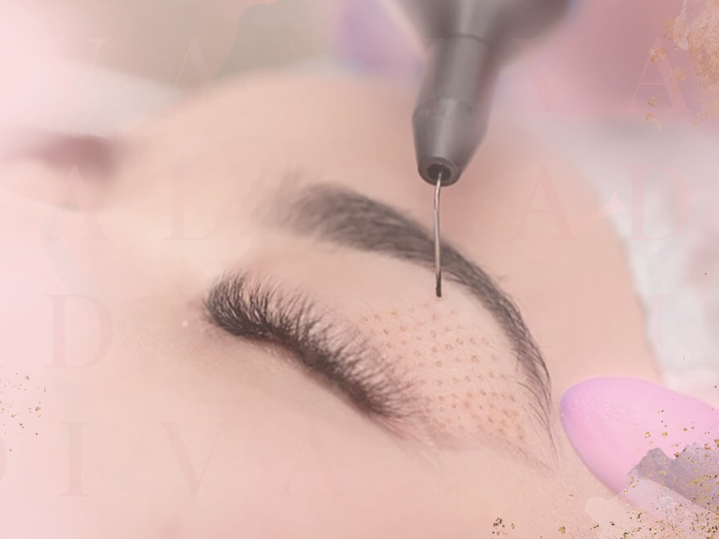 Plexr Plus: The Non-Surgical Eyelid Lift That's Changing Everything