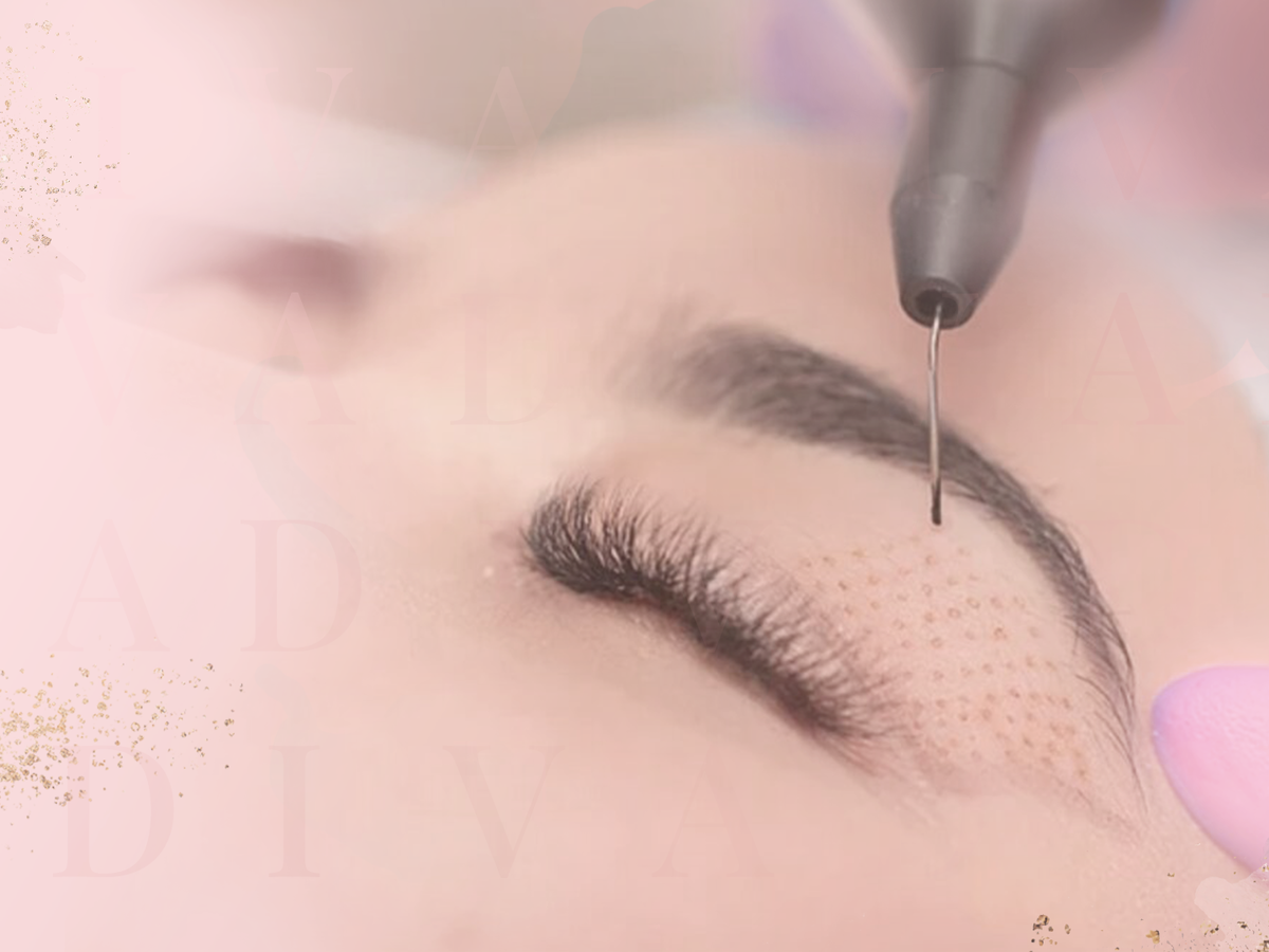 Skin Resurfacing
